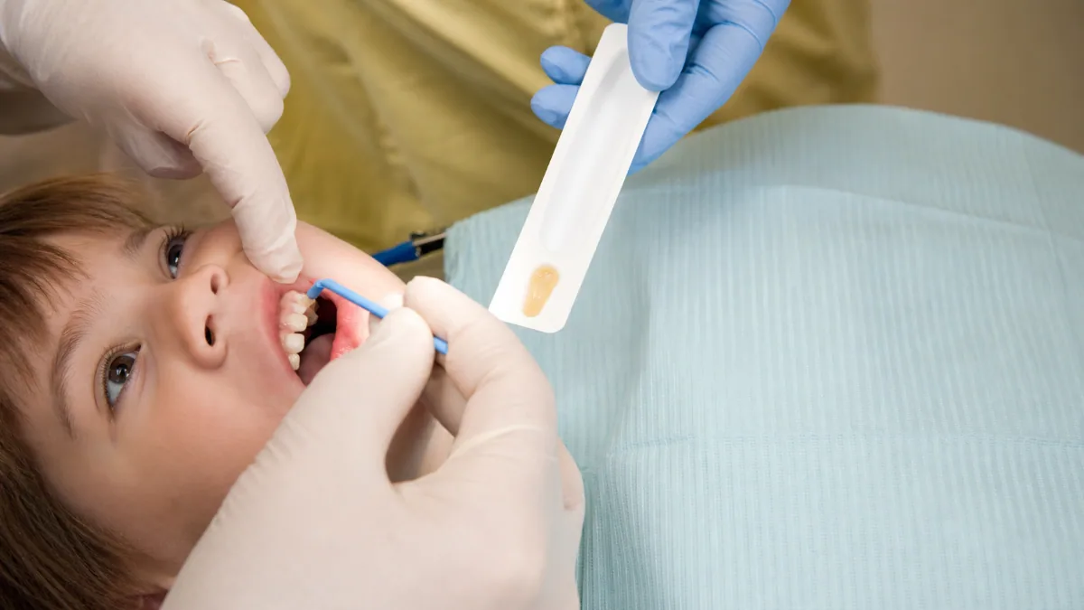 Step-by-step fluoride treatment procedure in North York showing a child receiving professional fluoride varnish application on primary teeth with a dental applicator brush by a hygienist.