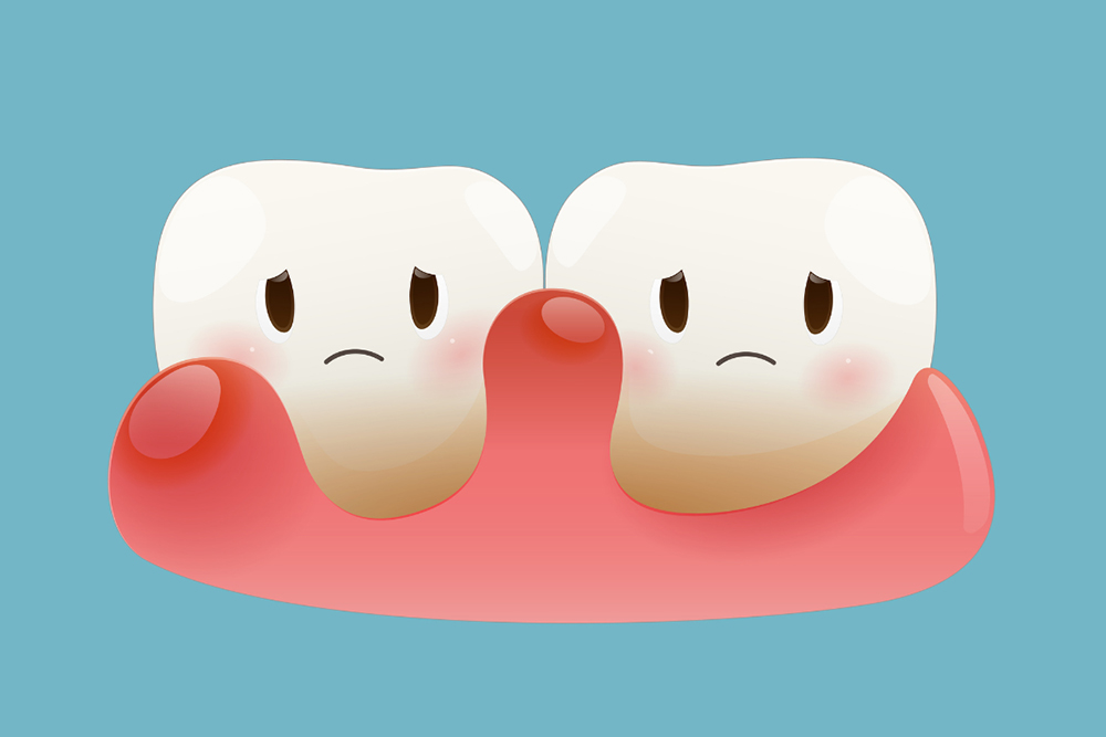 Dentist on Avenue Rd: Advanced Periodontal Therapy