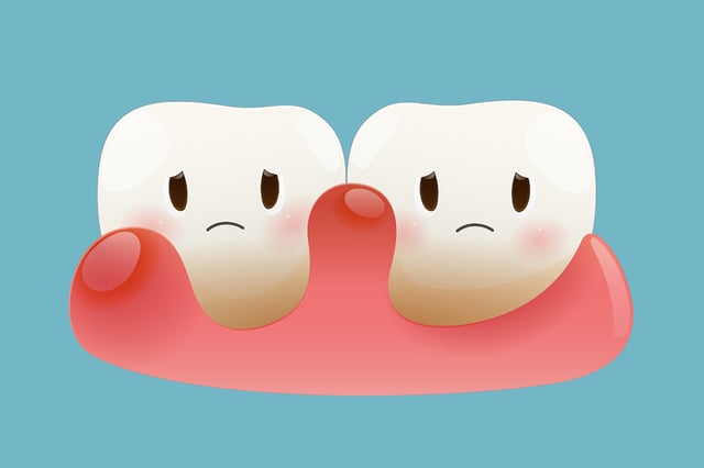 Illustration of inflamed gums between two teeth representing periodontal disease treated by dentist on Avenue Rd
